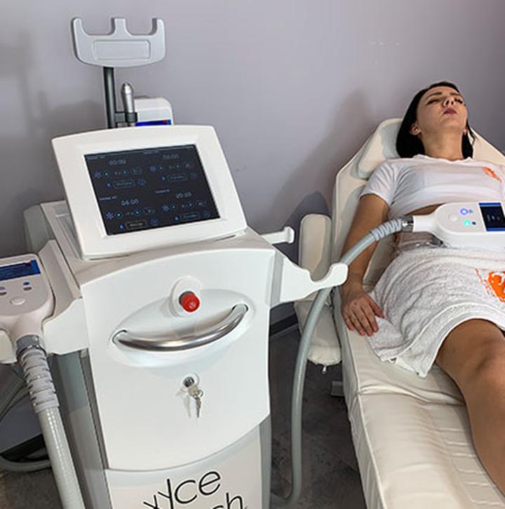 Sylwetka po kriolipolizie