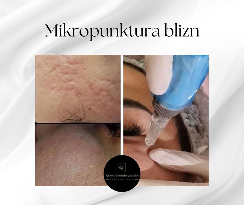 Proces gojenia skóry