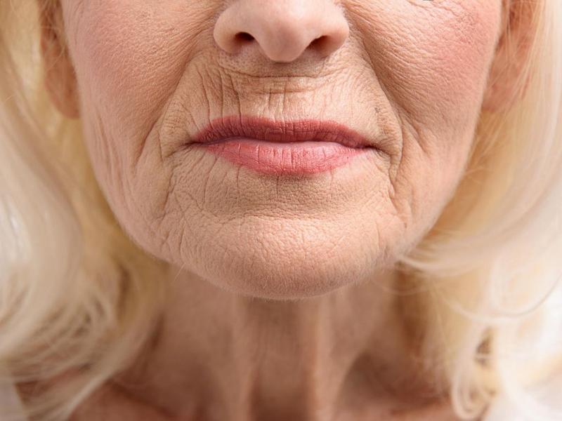 Zabiegi kosmetyczne na redukcję zmarszczek