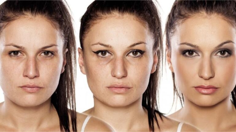 Osocze bogatopłytkowe – naturalna regeneracja, która przynosi efekty