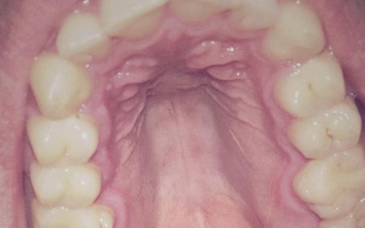 Tajemnice gotyckiego podniebienia – co warto wiedzieć?